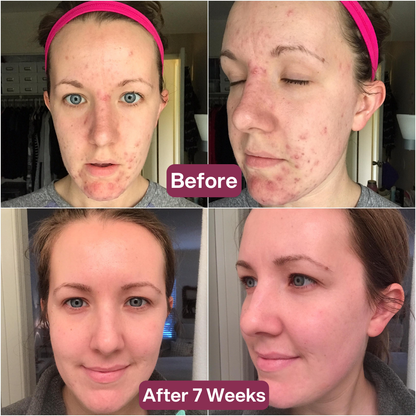 Dermly™ Advanced Snail 96 Mucin Face Mask