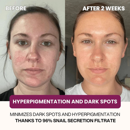 Dermly™ Snail 96 Mucin Mask