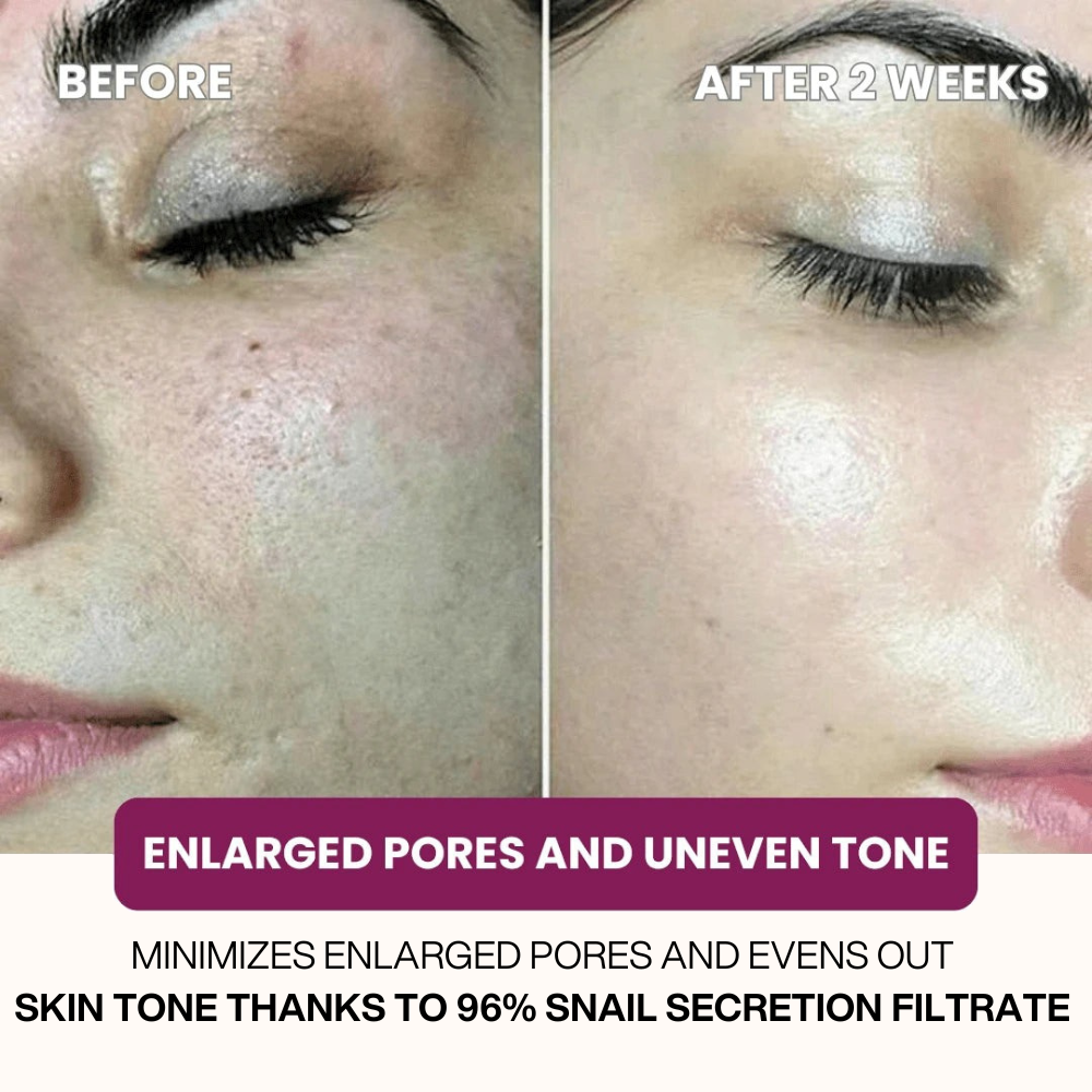 Dermly™ Snail 96 Mucin Mask